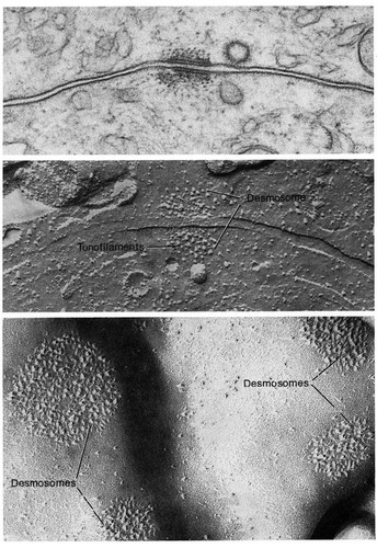 CIL:11215, Mus musculus, non-pigmented ciliary epithelial cell, epidermal cell