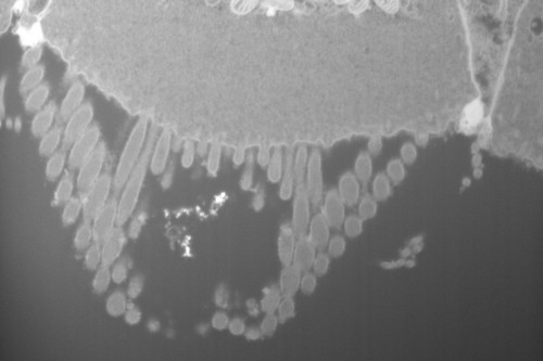 CIL: 50697, FIB-SEM Dataset of anti-PKHD1L1 Immuno-Gold Labeled Outer Hair Cell Stereocilia Bundles