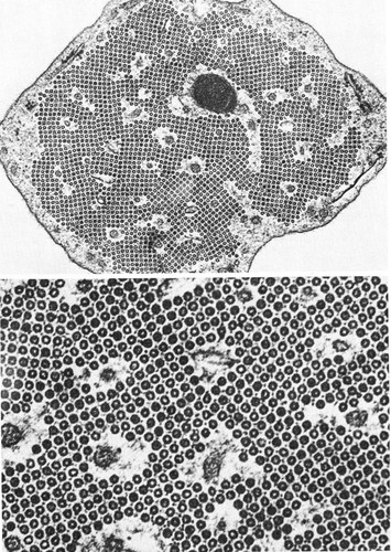 CIL:36053, Mammalia, pillar cell