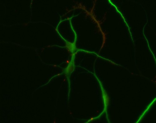 CIL:10273, Rattus, multipolar neuron