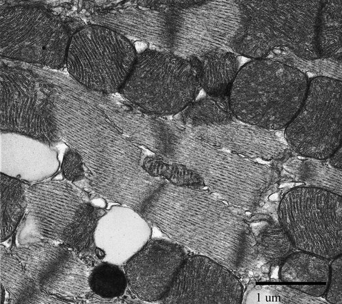 CIL:39727, Mus musculus, cardiac muscle cell