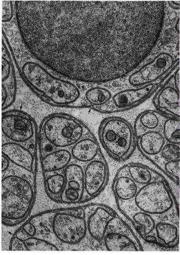 CIL:10948, Rattus, myelinating Schwann cell, peripheral neuron