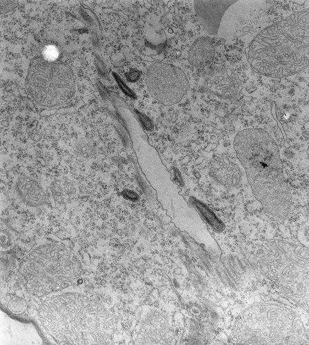 CIL:39724, Tetrahymena pyriformis, cell by organism, eukaryotic cell, Eukaryotic Protist, Ciliated Protist