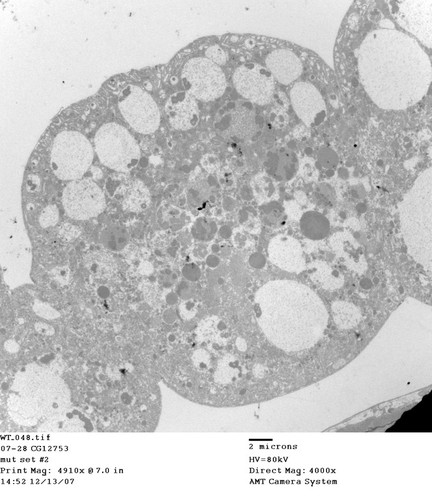 CIL:13468, Drosophila melanogaster, garland cell