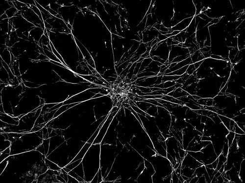 CIL:41025, Homo sapiens, motor neuron, stem cell