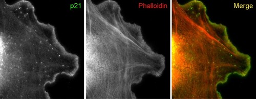 CIL:24796, fibroblast