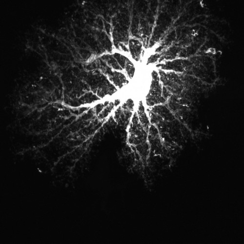 CIL:36346, Rattus norvegicus, astrocyte