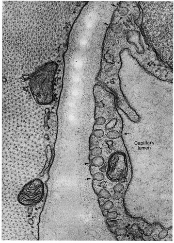 CIL:11137, Mammalia, endothelial cell