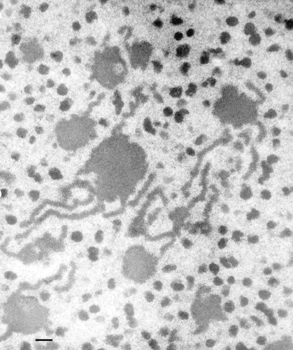 CIL:36660, Paramecium multimicronucleatum, cell by organism, eukaryotic cell, Eukaryotic Protist, Ciliated Protist