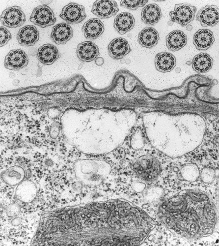 CIL:39502, Vorticella convallaria, cell by organism, eukaryotic cell, Eukaryotic Protist, Ciliated Protist