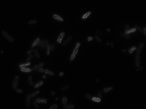 CIL: 54831, Alysiella filiformis, bacteria