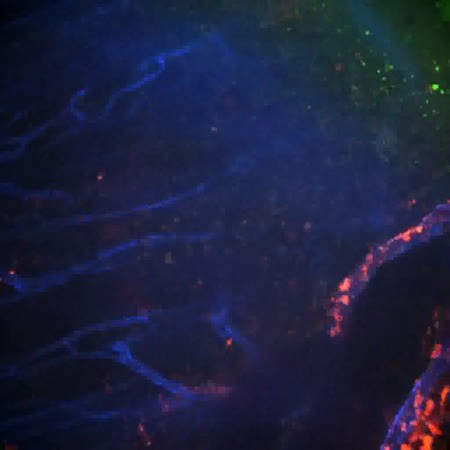 CIL:47544, Staphylococcus aureus, neutrophil, endothelial cell