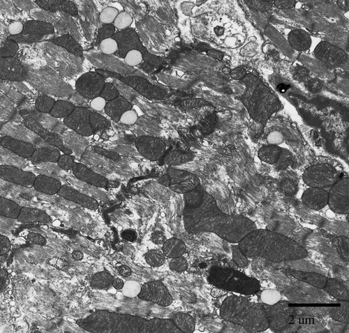 CIL:39781, Mus musculus, myofibril