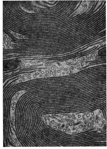 CIL:10765, Myotis lucifugus, acinar cell