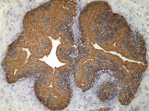 CIL:34255, Homo sapiens, endocrine-paracrine cell of prostate gland, basal cell of prostate epithelium, luminal cell of prostate epithelium, blood vessel endothelial cell, perineural cell, sheath cell, leukocyte, prostate stromal cell, smooth muscle cell of prostate