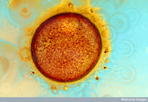 CIL:39092, Homo sapiens, egg, sperm, cumulus cell