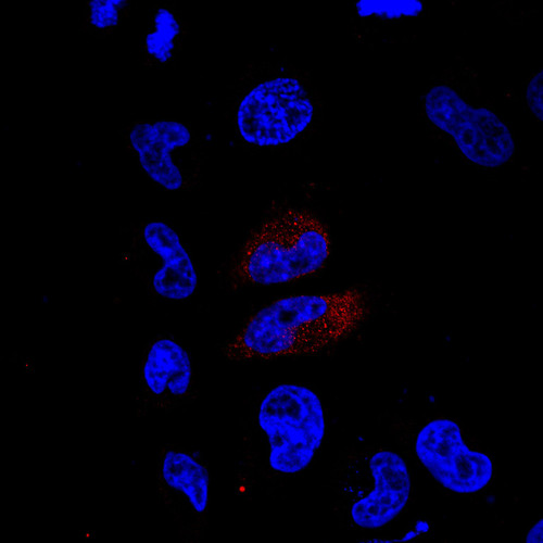 CIL: 53673, Homo sapiens, HeLa