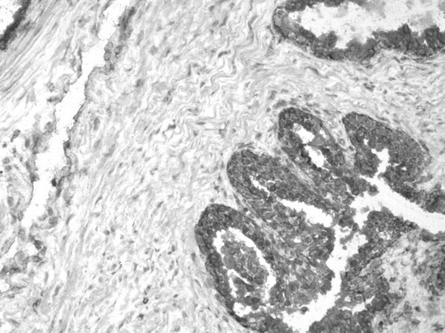 CIL:32380, Homo sapiens, endocrine-paracrine cell of prostate gland, basal cell of prostate epithelium, luminal cell of prostate epithelium, blood vessel endothelial cell, perineural cell, sheath cell, leukocyte, prostate stromal cell, smooth muscle cell of prostate