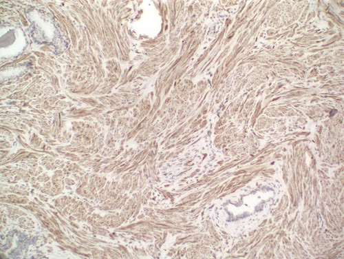 CIL:33472, Homo sapiens, endocrine-paracrine cell of prostate gland, basal cell of prostate epithelium, luminal cell of prostate epithelium, blood vessel endothelial cell, perineural cell, sheath cell, leukocyte, prostate stromal cell, smooth muscle cell of prostate