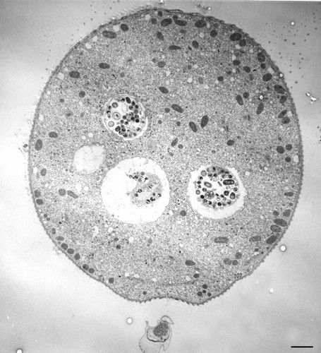 CIL:36246, Vorticella convallaria, cell by organism, eukaryotic cell, Eukaryotic Protist, Ciliated Protist