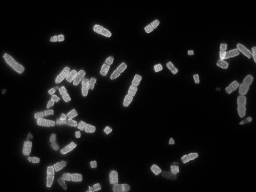 CIL: 54833, Simonsiella muelleri, bacteria