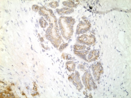 CIL:33485, Homo sapiens, endocrine-paracrine cell of prostate gland, basal cell of prostate epithelium, luminal cell of prostate epithelium, blood vessel endothelial cell, perineural cell, sheath cell, leukocyte, prostate stromal cell, smooth muscle cell of prostate