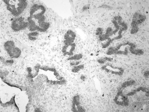 CIL:33550, Homo sapiens, endocrine-paracrine cell of prostate gland, basal cell of prostate epithelium, luminal cell of prostate epithelium, blood vessel endothelial cell, perineural cell, sheath cell, leukocyte, prostate stromal cell, smooth muscle cell of prostate