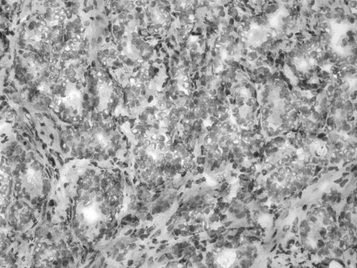 CIL:34081, Homo sapiens, endocrine-paracrine cell of prostate gland, basal cell of prostate epithelium, luminal cell of prostate epithelium, blood vessel endothelial cell, perineural cell, sheath cell, leukocyte, prostate stromal cell, smooth muscle cell of prostate