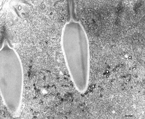 CIL:36683, Paramecium multimicronucleatum, cell by organism, eukaryotic cell, Eukaryotic Protist, Ciliated Protist