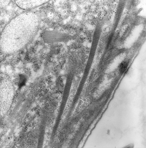 CIL:25899, uncultured scuticociliate, Conchophthirus curtus, cell by organism, eukaryotic cell, Eukaryotic Protist, Ciliated Protist