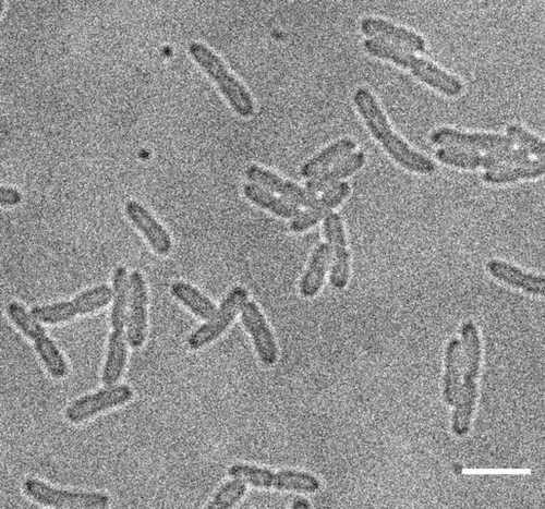 CIL: 54706, Bacteria E coli, MC1061