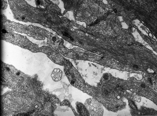 CIL:10439, Rana catesbeiana, barrier epithelial cell