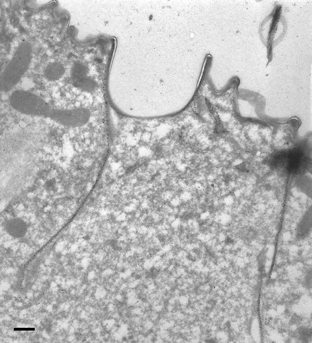 CIL:9852, Paramecium tetraurelia, cell by organism, eukaryotic cell, Eukaryotic Protist, Ciliated Protist