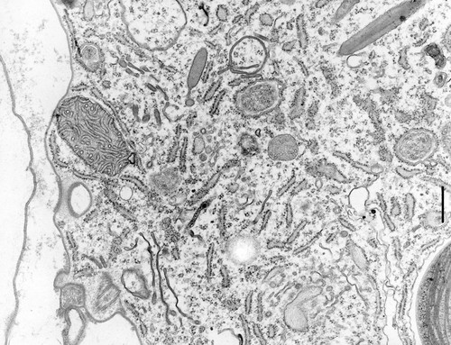 CIL:9698, Coleps hirtus, eukaryotic cell, Eukaryotic Protist, Ciliated Protist