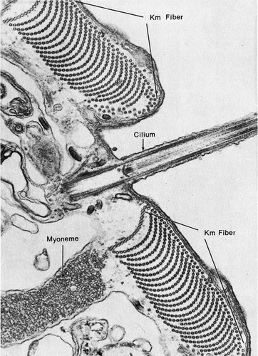 CIL:36049, Stentor coeruleus