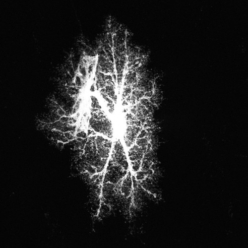 CIL:39939, Rattus norvegicus, astrocyte, astrocyte of the hippocampus