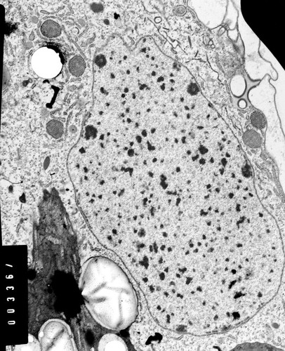 CIL:38825, Coleps hirtus, eukaryotic cell, Eukaryotic Protist, Ciliated Protist