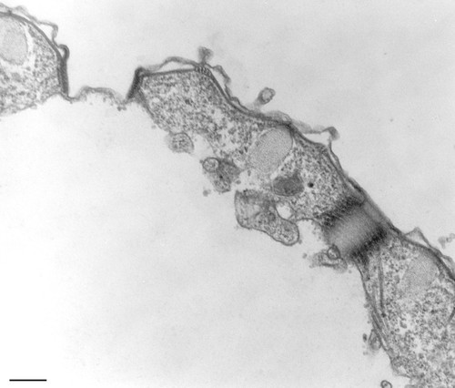 CIL:36233, Tetrahymena pyriformis, cell by organism, eukaryotic cell, Eukaryotic Protist, Ciliated Protist