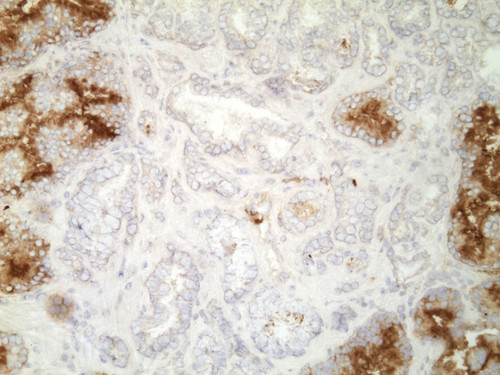 CIL:32513, Homo sapiens, endocrine-paracrine cell of prostate gland, basal cell of prostate epithelium, luminal cell of prostate epithelium, blood vessel endothelial cell, perineural cell, sheath cell, leukocyte, prostate stromal cell, smooth muscle cell of prostate