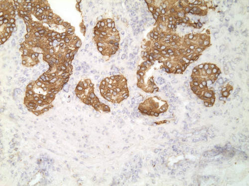 CIL:34270, Homo sapiens, endocrine-paracrine cell of prostate gland, basal cell of prostate epithelium, luminal cell of prostate epithelium, blood vessel endothelial cell, perineural cell, sheath cell, leukocyte, prostate stromal cell, smooth muscle cell of prostate