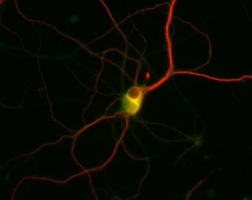 CIL:10392, Rattus, multipolar neuron