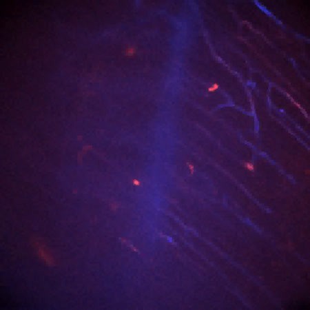 CIL:47538, Staphylococcus aureus, neutrophil, endothelial cell