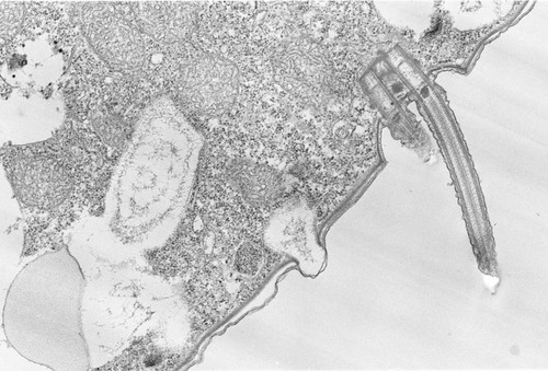 CIL:2856, Colpoda cucullus, cell by organism, eukaryotic cell, Eukaryotic Protist, Ciliated Protist