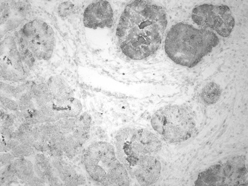 CIL:33556, Homo sapiens, endocrine-paracrine cell of prostate gland, basal cell of prostate epithelium, luminal cell of prostate epithelium, blood vessel endothelial cell, perineural cell, sheath cell, leukocyte, prostate stromal cell, smooth muscle cell of prostate