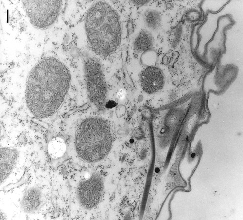 CIL:13157, Paramecium multimicronucleatum, cell by organism, eukaryotic cell, Eukaryotic Protist, Ciliated Protist