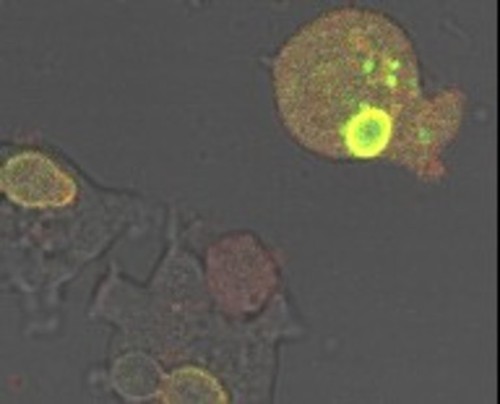 CIL:7326, Dictyostelium discoideum, cell by organism, eukaryotic cell, amoeboid cell, Eukaryotic Protist