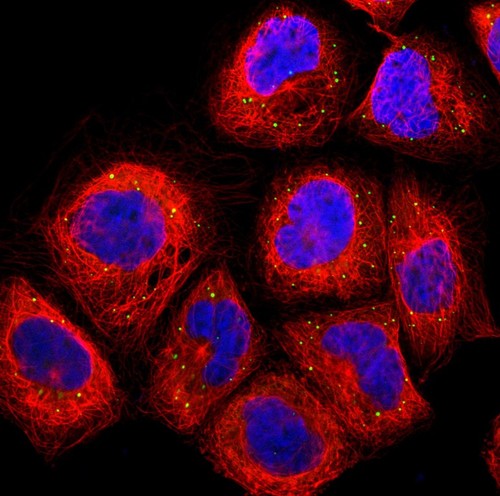 CIL:41676, Homo sapiens, epidermoid carcinoma