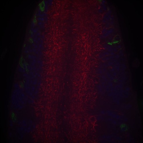 CIL: 54677, Drosophila melanogaster, astrocytes (red)