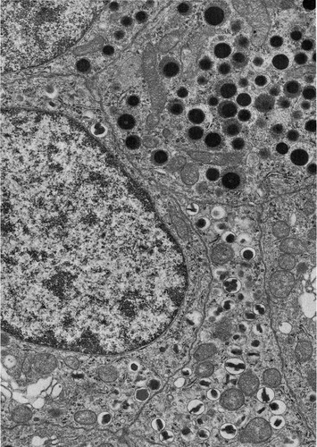 CIL:36008, Homo sapiens, epithelial cell of pancreas