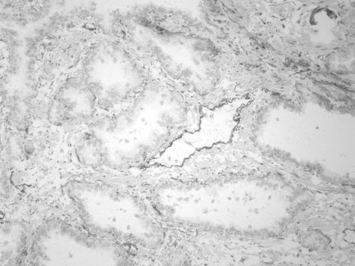 CIL:33953, Homo sapiens, endocrine-paracrine cell of prostate gland, basal cell of prostate epithelium, luminal cell of prostate epithelium, blood vessel endothelial cell, perineural cell, sheath cell, leukocyte, prostate stromal cell, smooth muscle cell of prostate